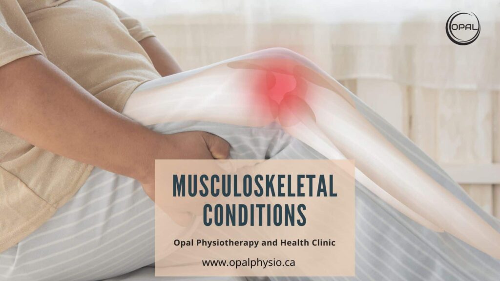 Musculoskeletal Conditions