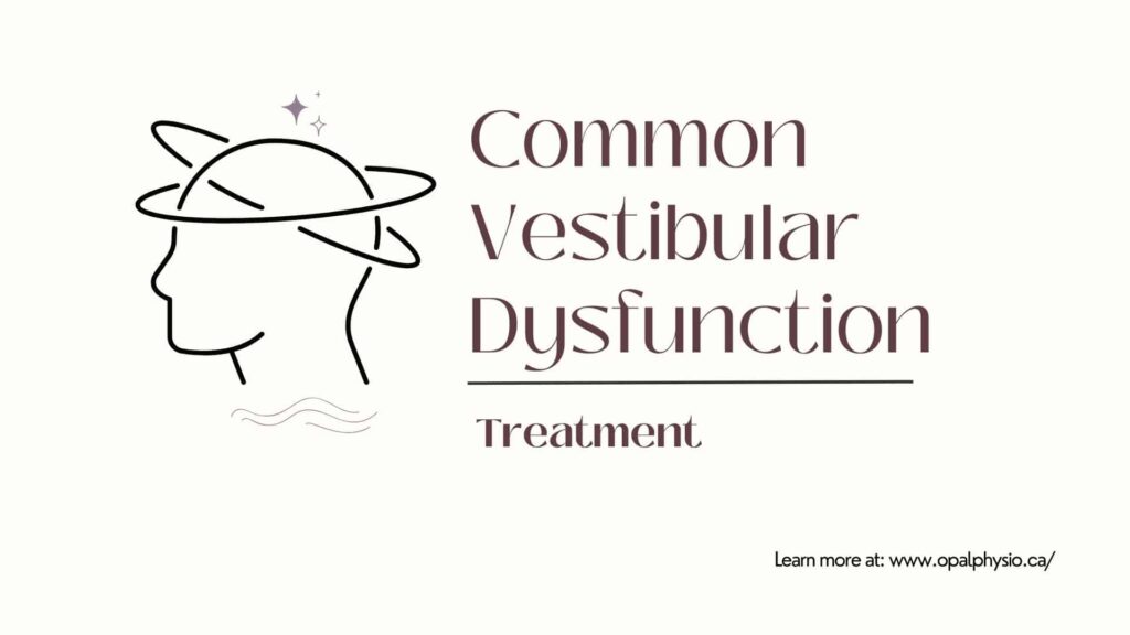 Common Vestibular Dysfunction Treatment
