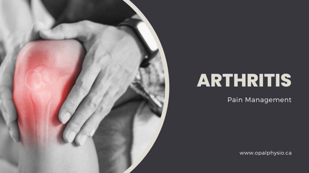 Arthritis Pain Management