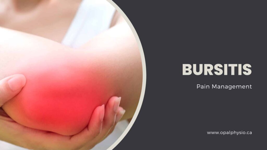 Bursitis Pain Management