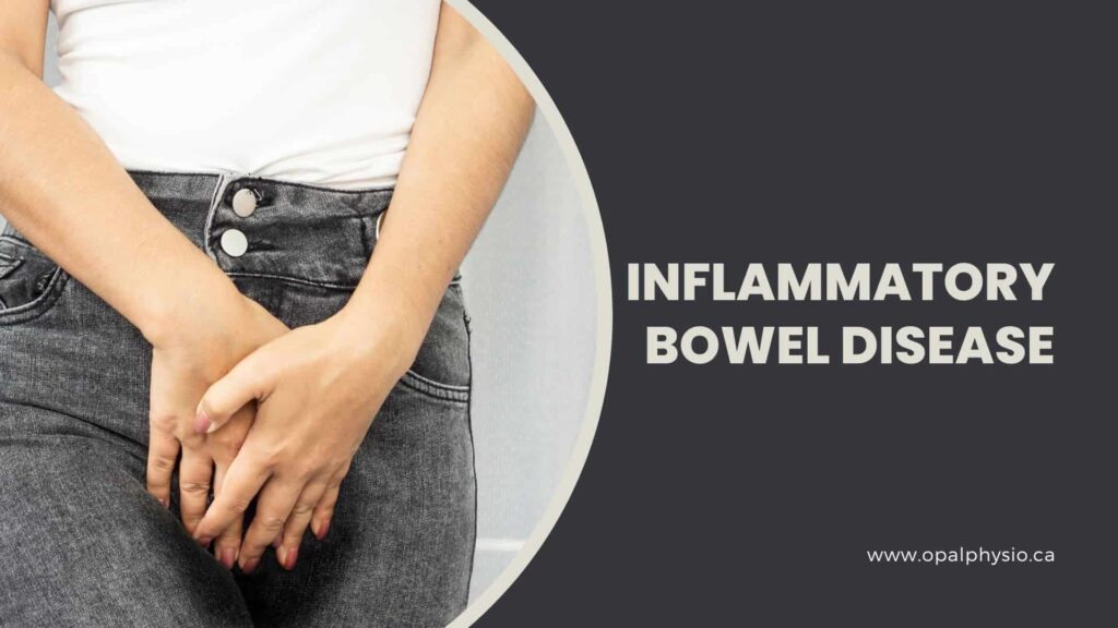 Inflammatory Bowel Disease Treatment - IBD Management