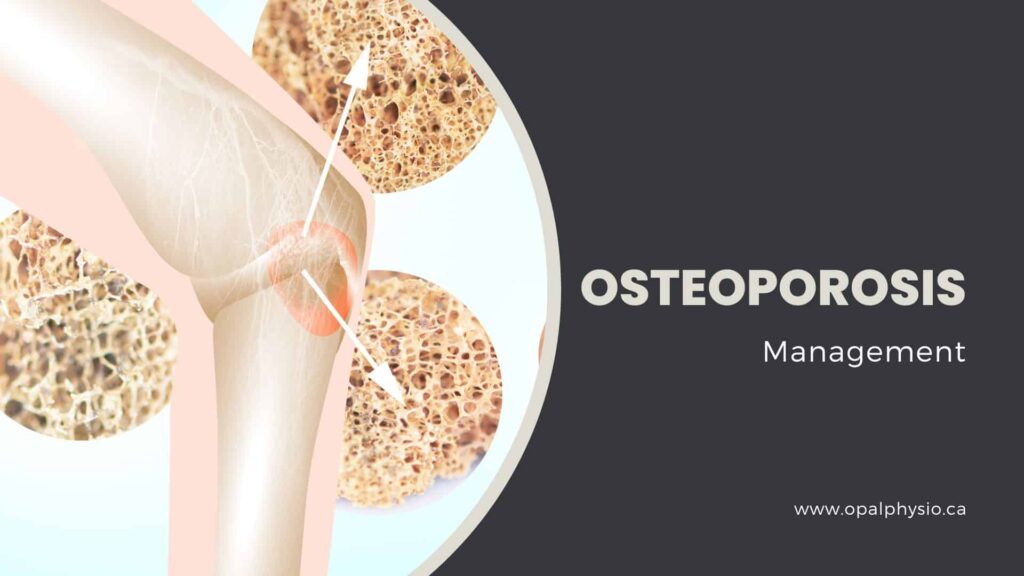 Osteoporosis Treatment in Langley