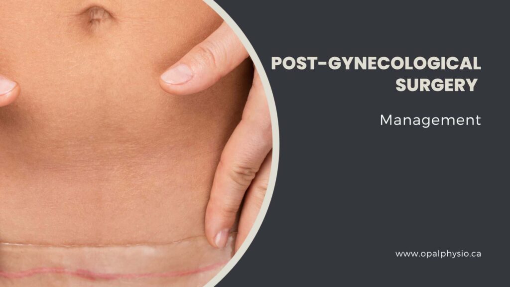 Post-Gynecological Surgery Management
