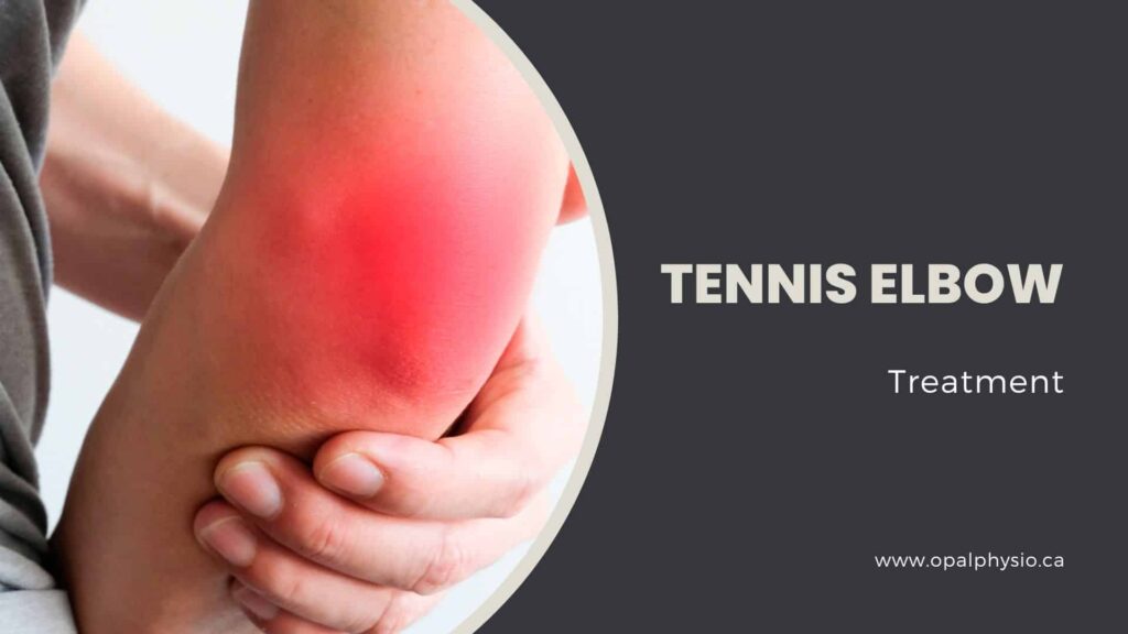 Tennis Elbow Treatment