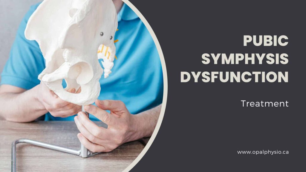 Pubic Symphysis Dysfunction Treatment