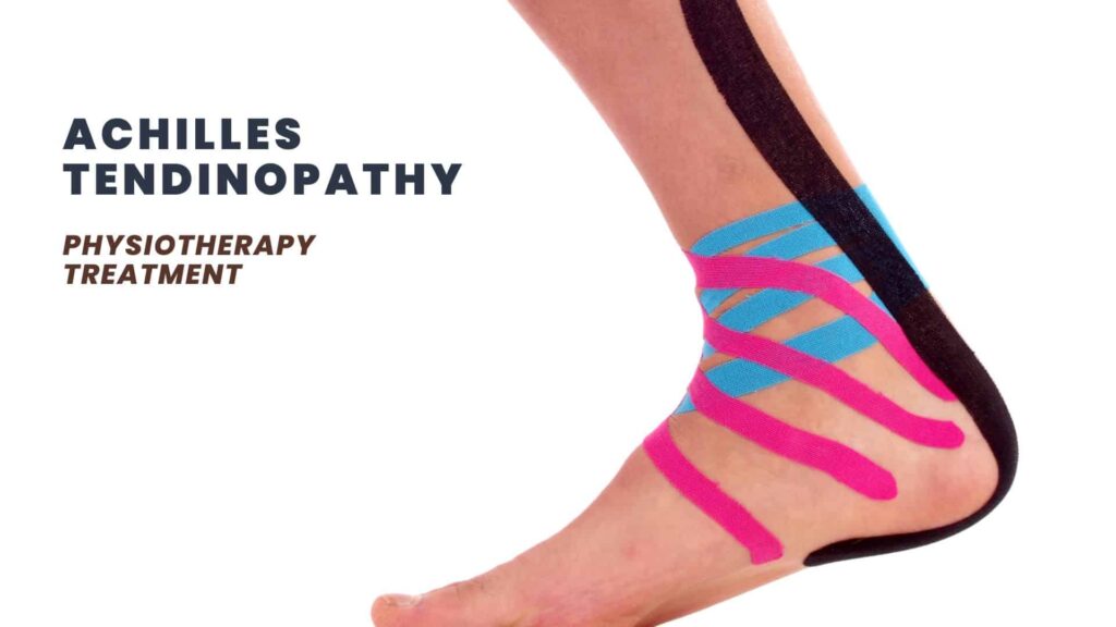 Achilles Tendinopathy Physiotherapy Treatment