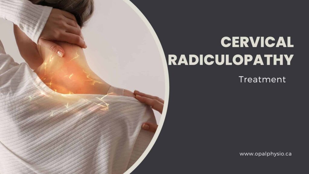 Cervical Radiculopathy Treatment
