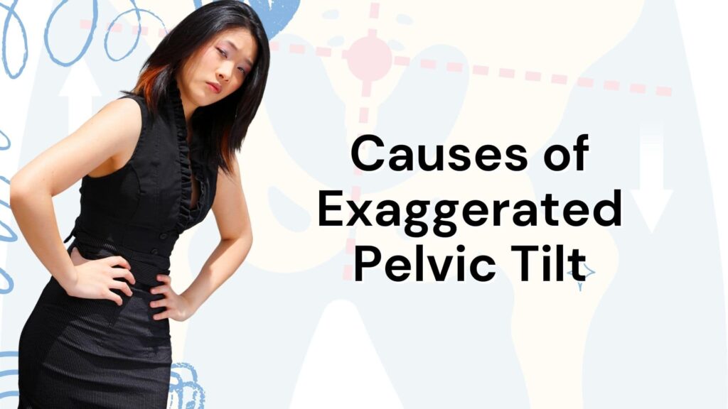 Causes of Exaggerated Pelvic Tilt