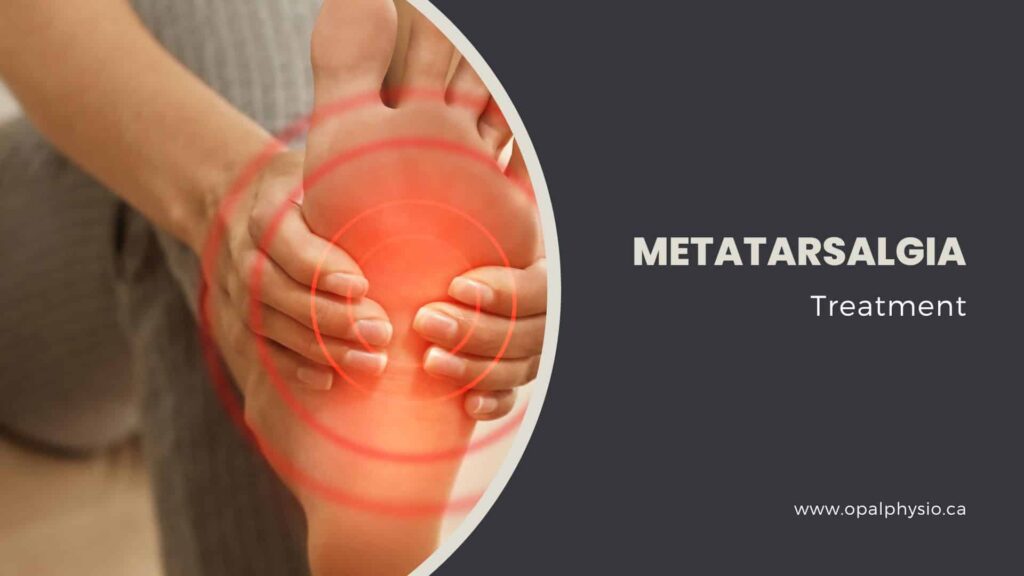 Metatarsalgia Treatment